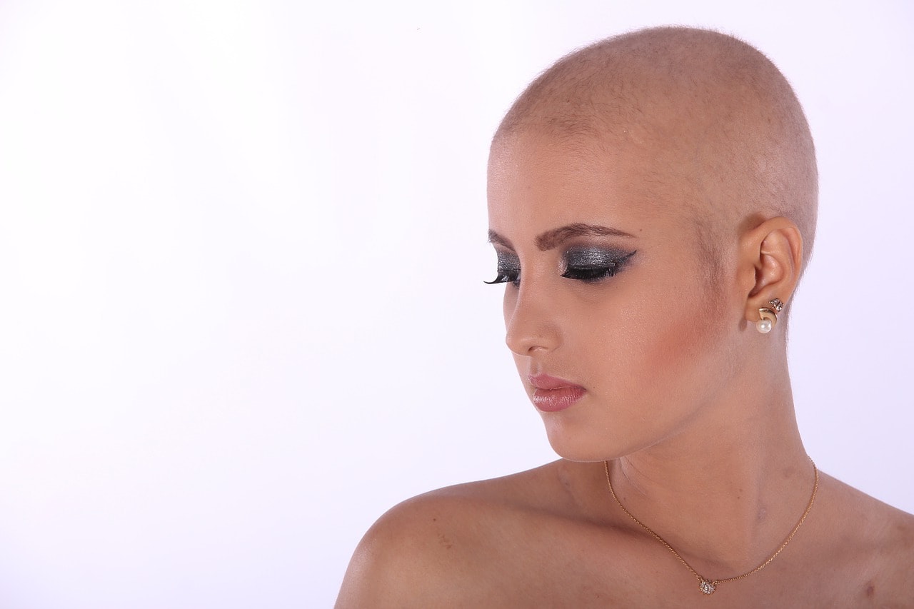 chemotherapy-hair-loss-min